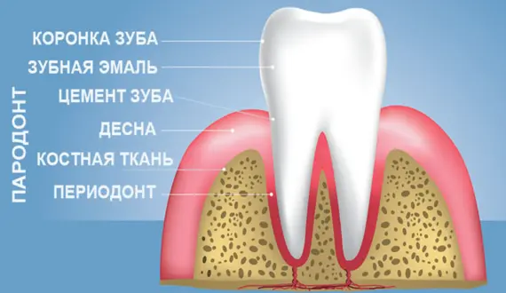 Пародонтит: симптомы, лечение и профилактика