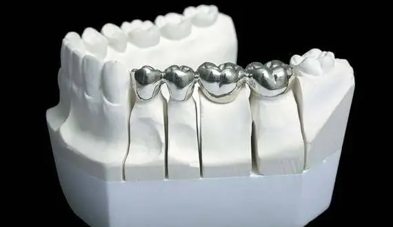8 мифов про коронки на зубы