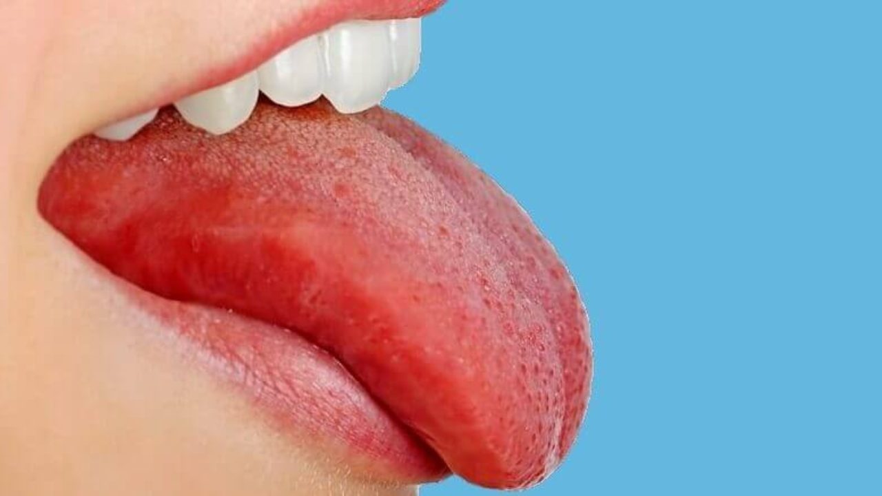 Воспаление под языком | Семейная стоматология