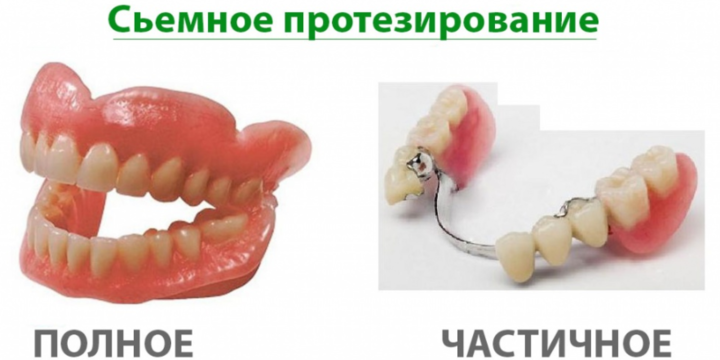 Уникальное руководство: протезы для зубов своими руками!